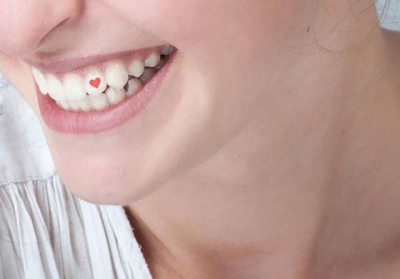 Набирает популярность новый тренд: тату на зубах