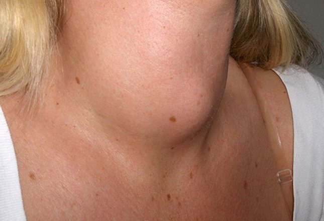 Болезни щитовидной железы, легких и печени видны на вашем лице! Вот как их распознать