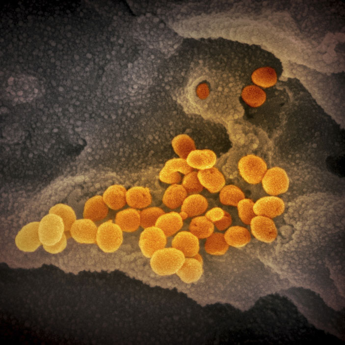 Вирионы SARS-CoV-2 высвобождаются из одной из клеток лабораторной культуры. Электронная микрофотография с сайта modernhealthcare.com