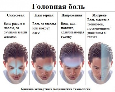 Гид по головной боли Гид по головной боли