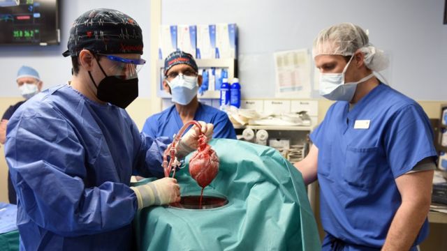 Pig heart transplant