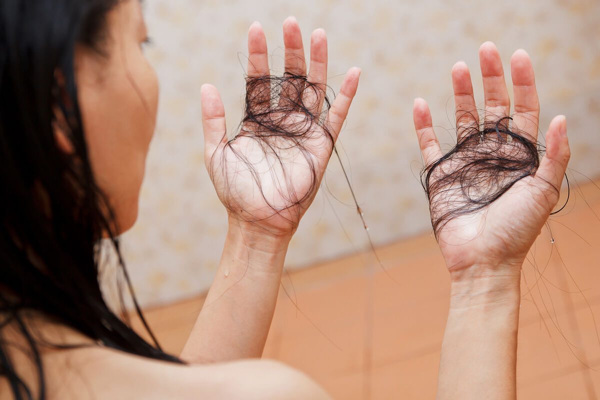 Врач Васильева: солнечные ожоги могут спровоцировать интенсивное выпадение волос