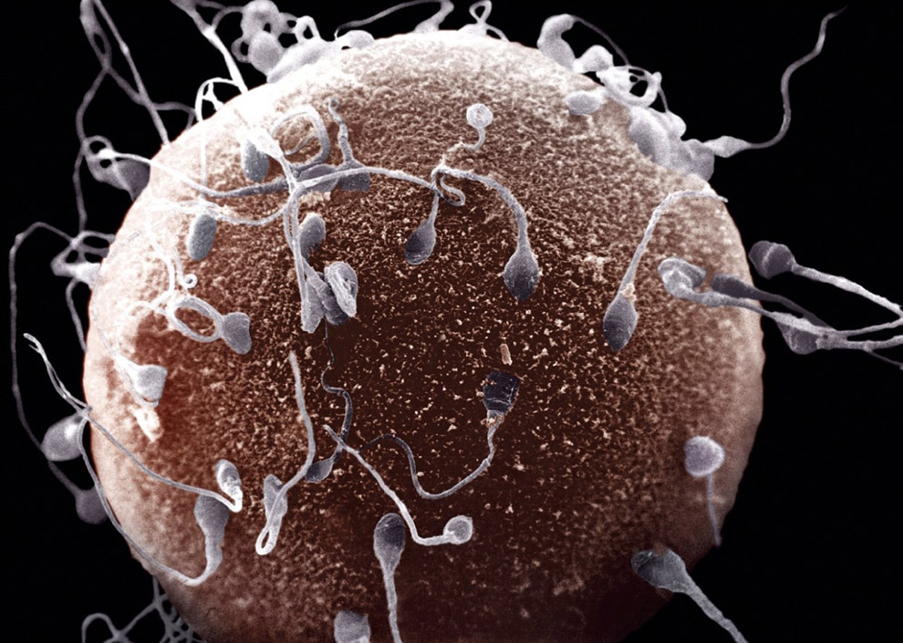 10 фактов о сперме человека сперматозоиды, сперматозоидов, яичка, всего, температура, спермы, человека, из самых, часов, объема, мошонки, со скоростью, около, чтобы, в длину, жидкости, движется, в минуту, в течение, занимает