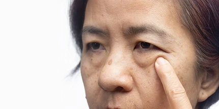 Почему дергается глаз: 11 самых частых и неочевидных причин медицина и здоровье,мышечные спазмы глаз