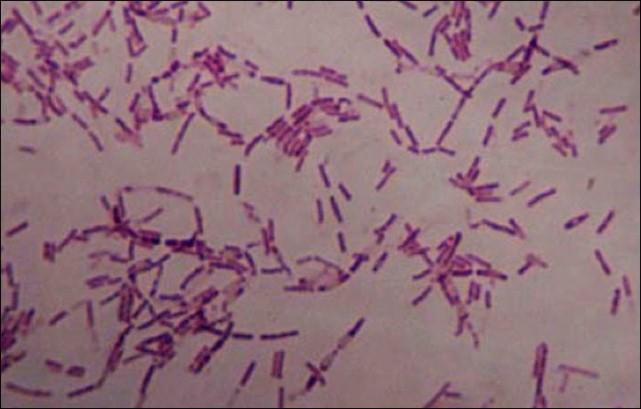bakteria-2.jpg