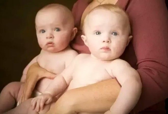 Furches Twins Age