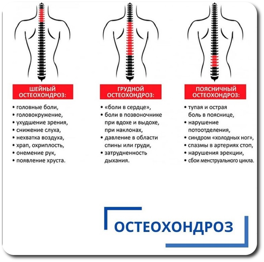 остеохондроз причина и лечение