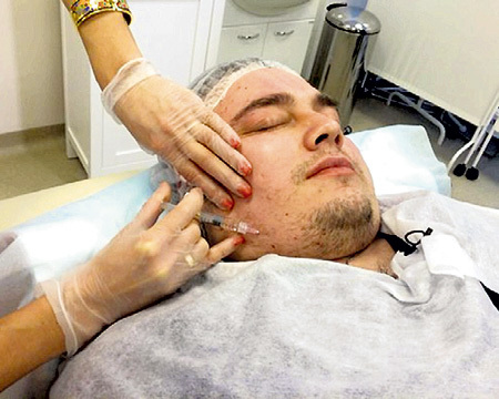 Косметолог сделала уколы, чтобы убрать морщинки. Фото: Vk.com