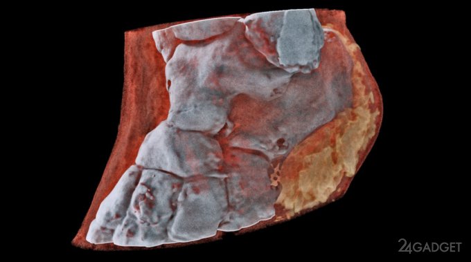Рентгеновские снимки вскоре станут трехмёрными и цветными (5 фото + видео)