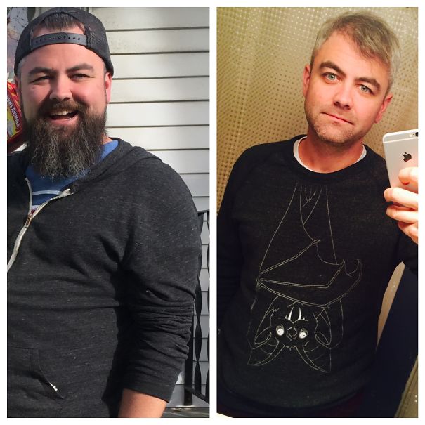 До и после: как меняется внешность человека, который перестает пить
