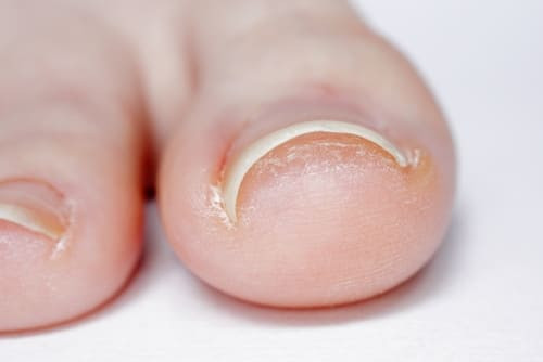 Врач научила способам определить болезни по внешнему виду ног