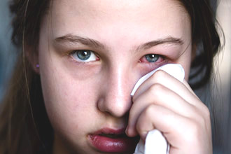 Девочка с красным глазом