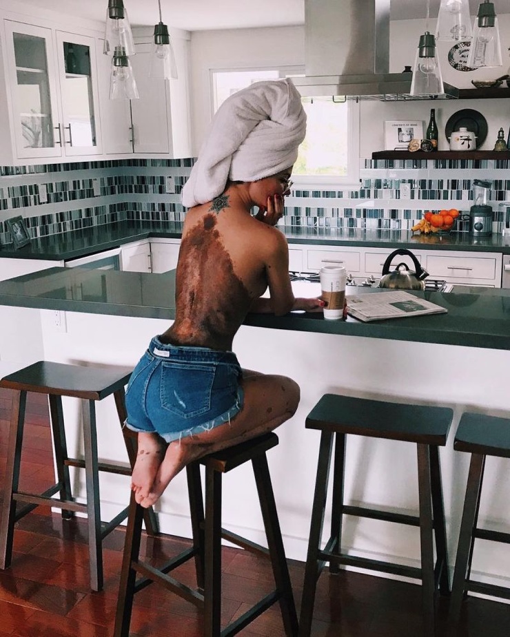 Девушка с огромной родинкой показалась в нижнем белье, и ее осыпали комплиментами 