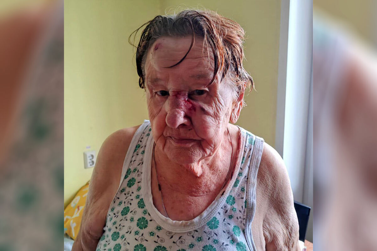 В красноярском пансионате проводят проверку после избиения 89-летней пенсионерки