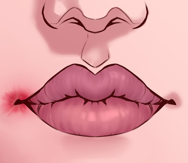 Что губы могут рассказать о вашем здоровье
