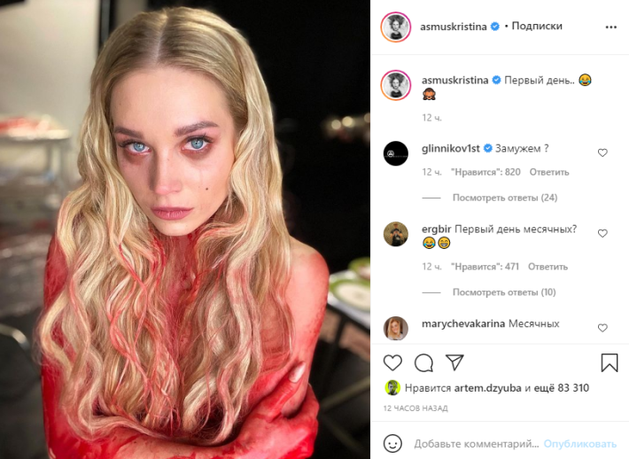 «Вас избили?»: «окровавленное» тело Асмус напугало поклонников Шоу-бизнес