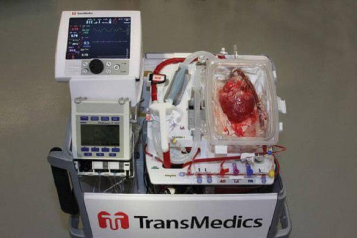 Как долго органы для трансплантации могут находиться вне тела? органа, трансплантации, органов, часов, является, времени, орган, самого, наиболее, органами, условиях, время, почки, которые, которая, сердце, человека, тканей, человеку, через