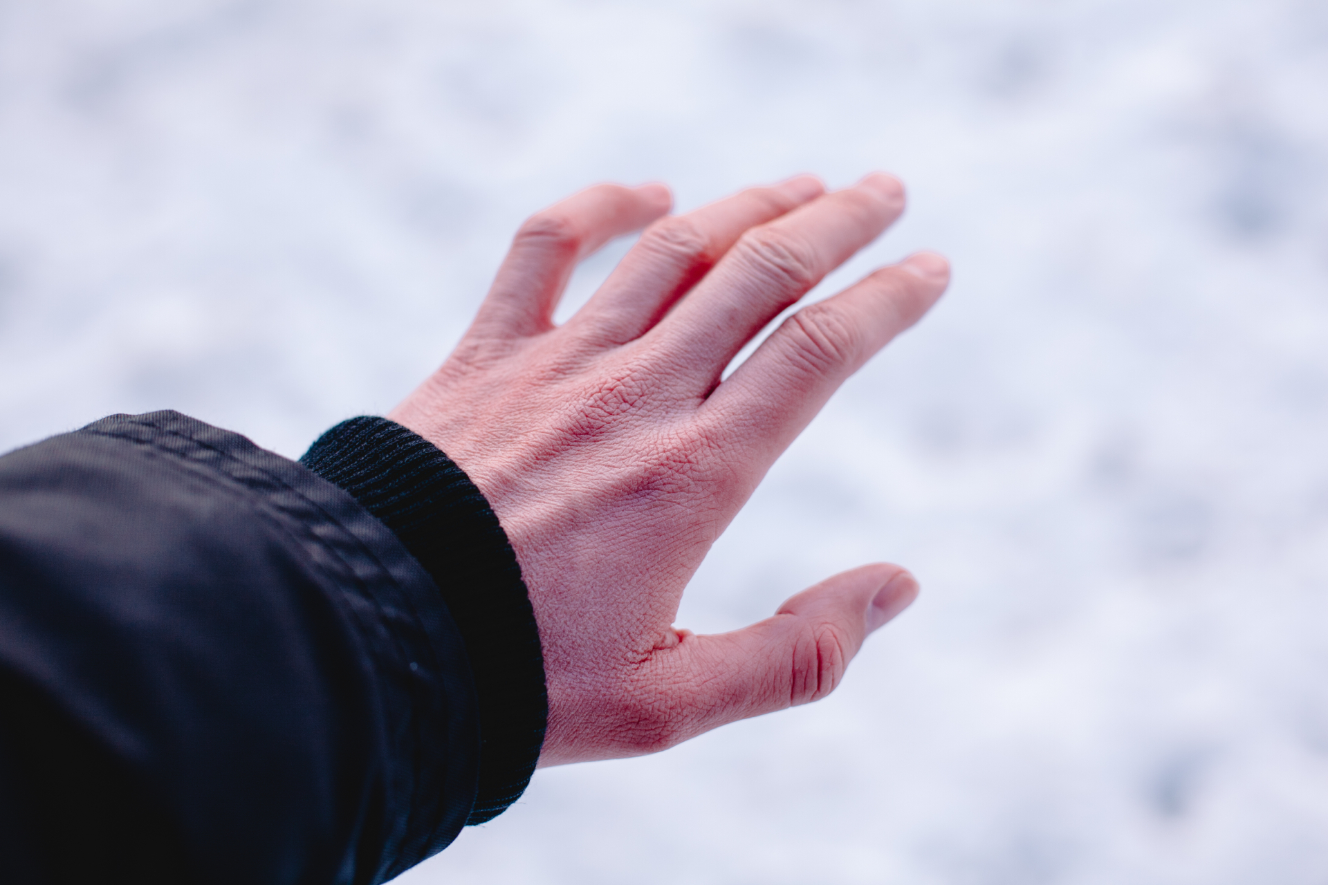 Отмороженные руки фото