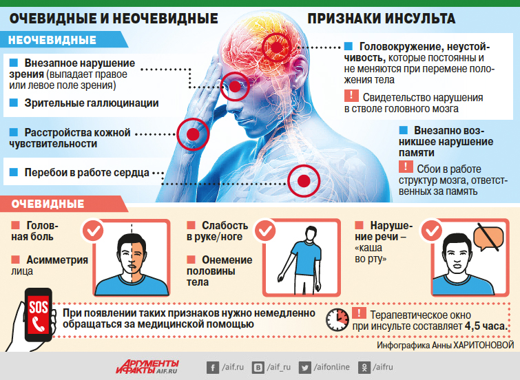 Сосуд выносит приговор. Как понять, насколько велик риск инсульта здоровье сосудов,инсульт,сердечно-сосудистые заболевания