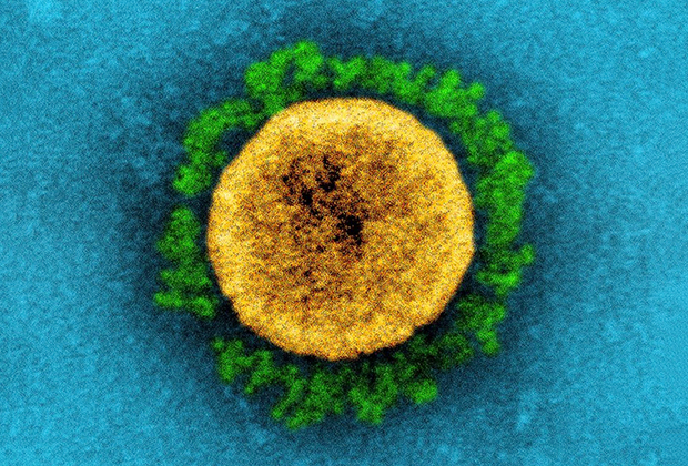 Мир борется с коронавирусом уже два года. Почему ученые не могут его победить? COVID19, коронавируса, SARSCoV2, более, штамм, процентов, вируса, вакцин, однако, вызывает, людей, клетки, ученые, которые, дельтавариант, пандемии, числа, вакцины, Однако, омикронвариант