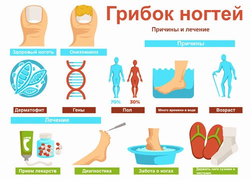 ТОП-15 препаратов от грибка на ногтях ногтей, особые, лечения, ногтя, грибки, препараты, также, инфекции, препарат, грибка, могут, против, использовать, может, средства, беременности, грибок, Применяется, лечение, некоторых