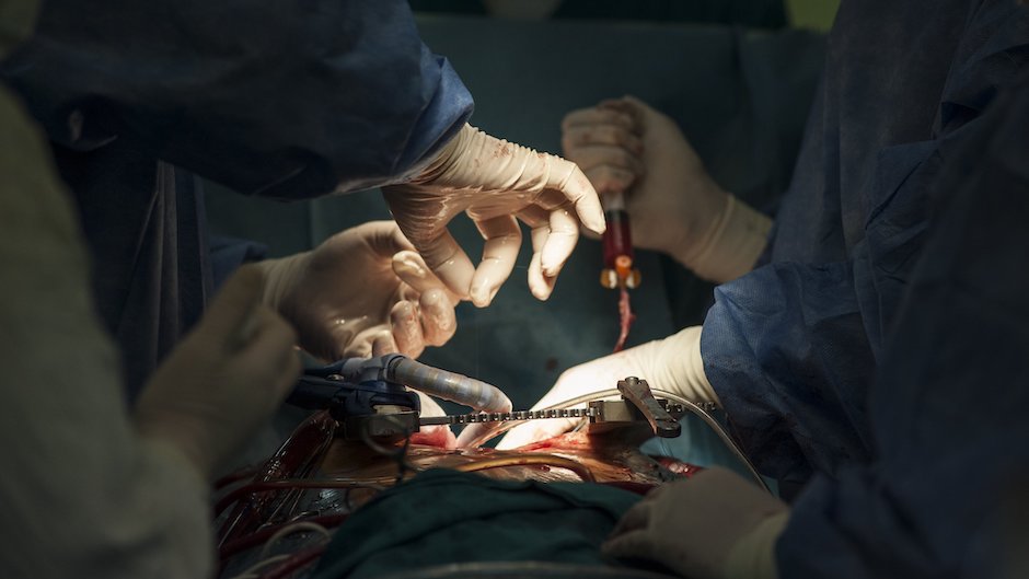 Семь популярных и опасных мифов о хирургии