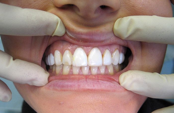 10 Разожмите ему зубы люди, первая помощь, познавательно
