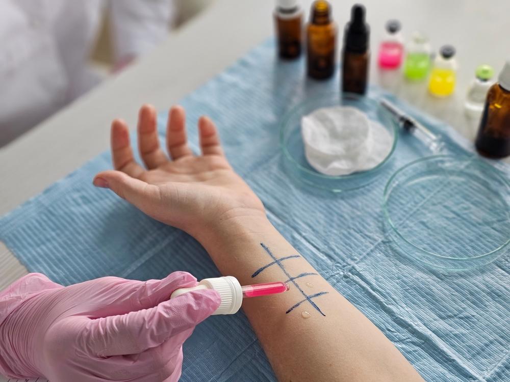 Как заранее узнать, если ли у вас аллергия на анестезию — рассказывает иммунолог аллергии, средства, например, препараты, аллергия, лекарственной, рублей, стоимость, антитела, реакции, тестов, другие, симптомов, поэтому, необходимо, вызывают, всего, человек, аллергию, приема