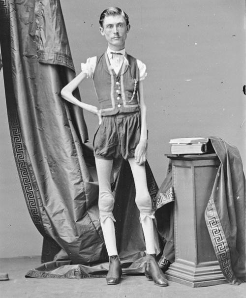На фото Исаак спрэг, знаменитый в XIX веке Человек - Скелет, который ездил по всему миру и удивлял публику своей незаурядной внешностью.