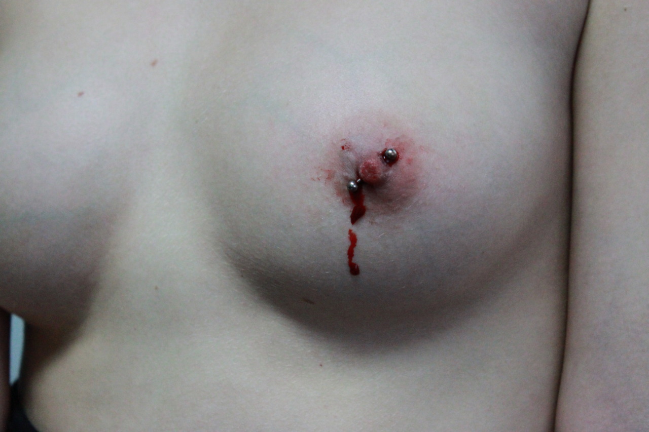 кровь из соска груди у женщин фото 118