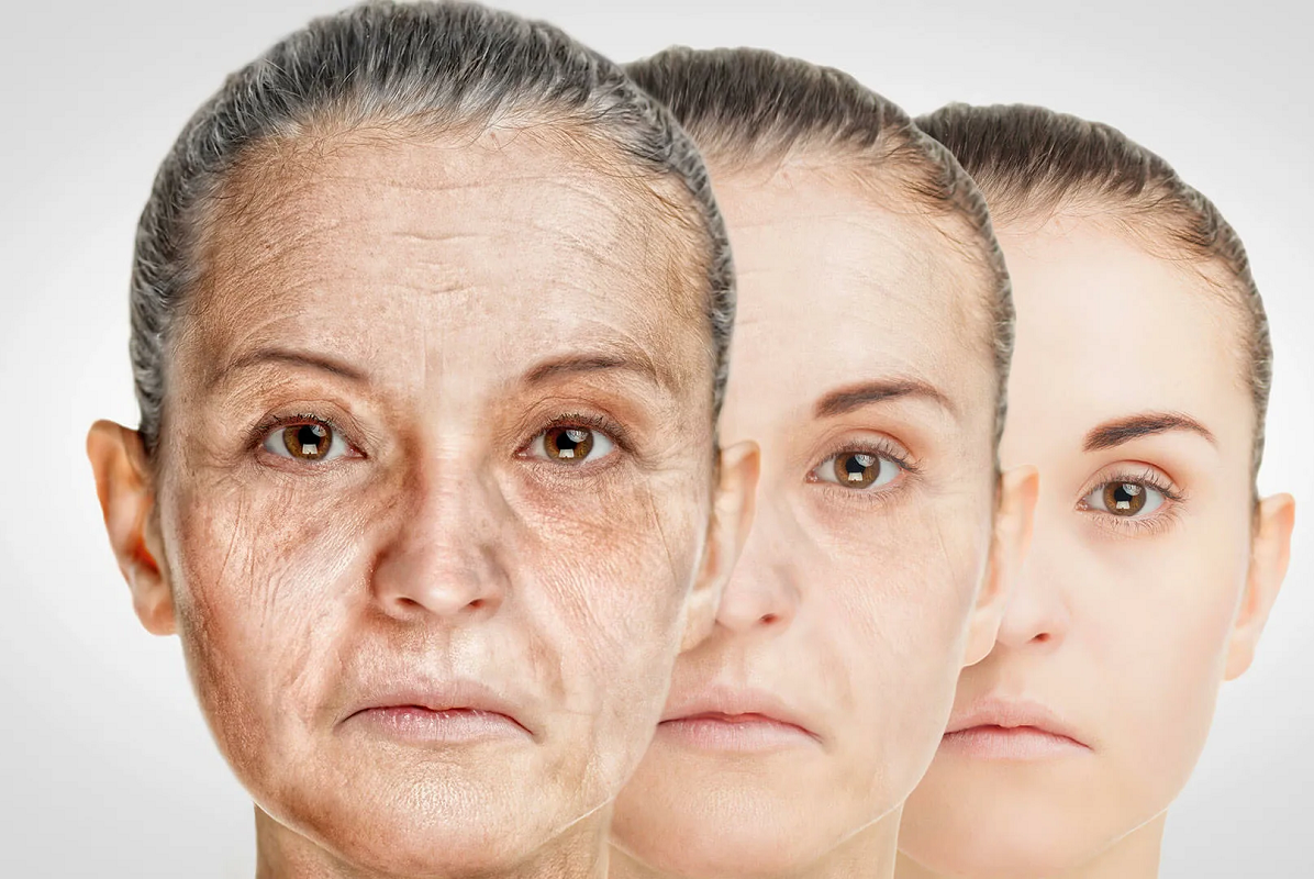 Преждевременное испарение кожи. Молодая и Старая кожа. Старение кожи. Лицо человека. Что такое биологический возраст человека