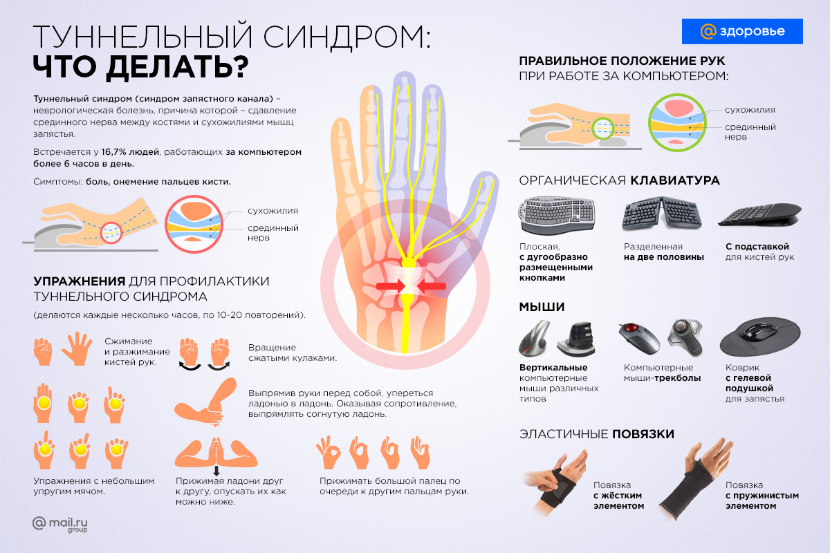 Что делает правая рука. Туннельный синдром кисти. Немеет кисть правой руки причины. Синдром тональной кисти. Туннельный синдром запястья кисти.