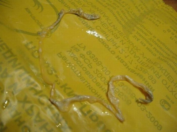 Маленькие точки на туалетной бумаге. Личинки глистов энтеробиоз. Глисты на туалетной бумаге. Черные точки на туалетной бумаге. Червяки аскариды в кале.