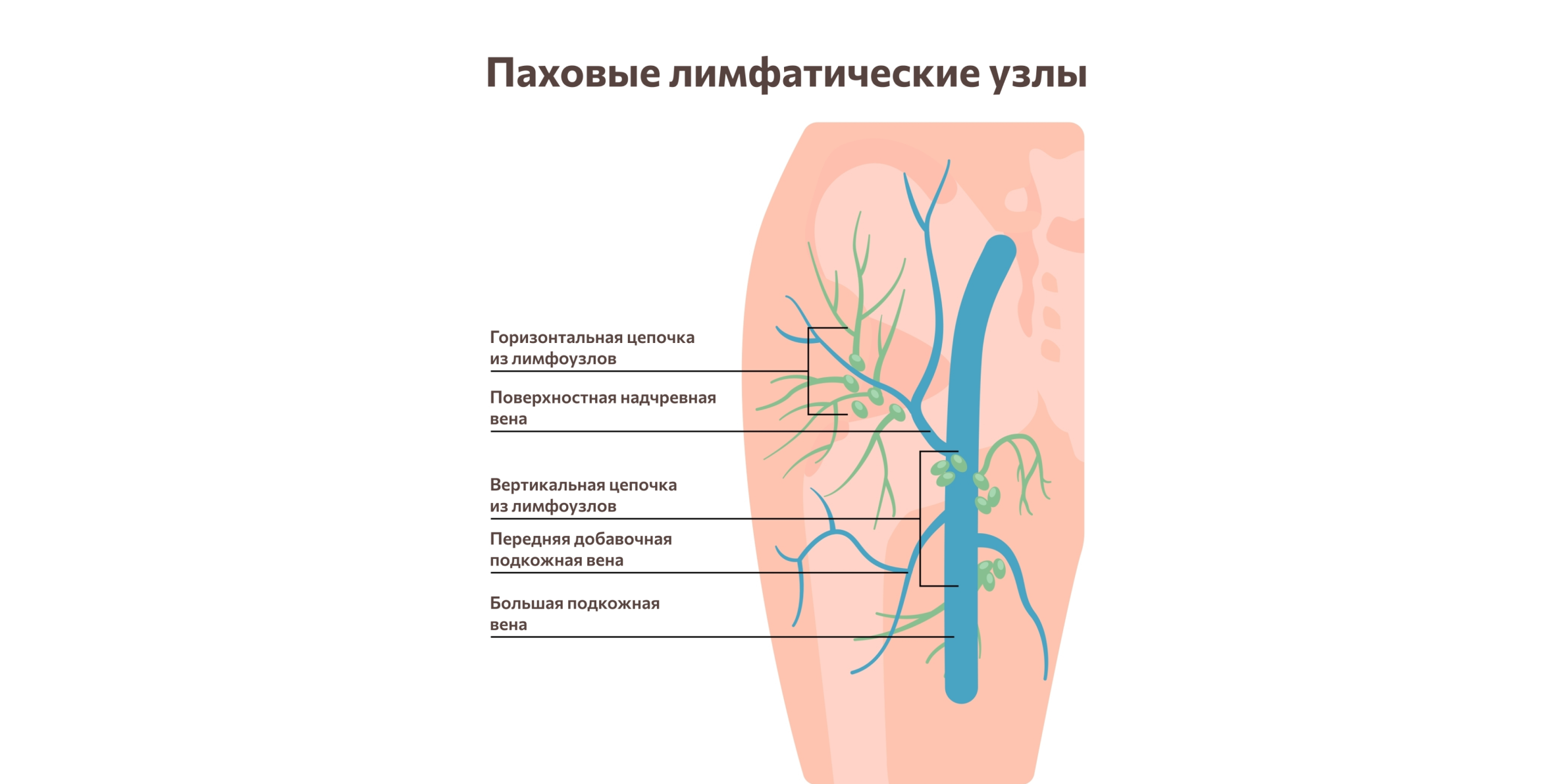 Паховые лимфоузлы