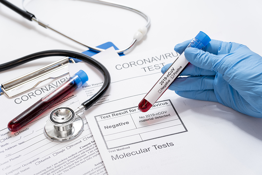 УПЦ отдала в регионы Украины 100 тыс. тестов на коронавирус