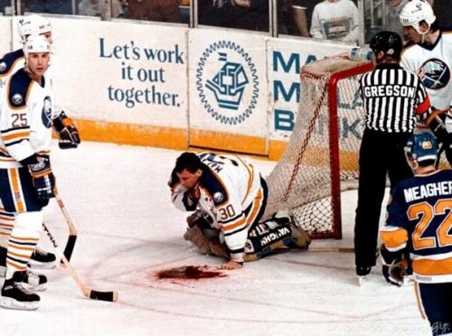 В 1989 году канадскому вратарю Клинту маларчуку лезвие конька разрезало шею, повредив сонную артерию и яремную вену.