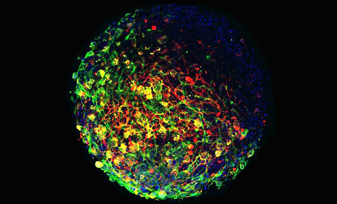 Ученые работали над созданием искусственного мозга и заметили, что он вырастил глаза и различает свет Культура
