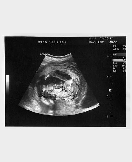 Рэпер Lil Nas X снялся в образе беременного мужчины в новой фотосессии Шоу-бизнес