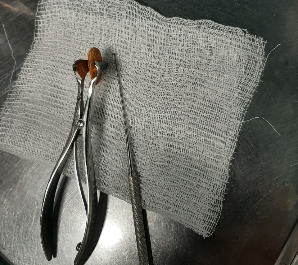Врачи из больницы в Раменском вытащили орех из носа у дошкольника