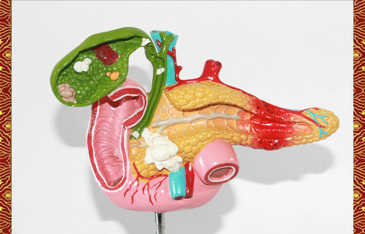Макет поджелудочной железы, 12-перстной кишки и желчного пузыря. Фото с сайта ru.aliexpress.com