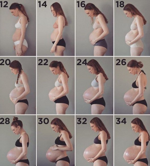 Родить тройню: будущая мама отчитывается о нелегкой миссии беременность, интересно, мама, опыт вынашивания, отчет, тройня, тройняшки, тяжкая ноша