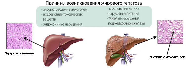 Висцеральный жир: чем опасен и как от него избавиться висцерального, висцеральный, достаточно, низкой, организма, питание, который, чтобы, избавиться, очень, жизненно, может, случае, лишнего, существенно, жираКак, узнать, также, которые, нашего