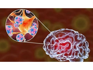 Ученые доказали, что коронавирус повреждает мозг. Какие последствия? геополитика