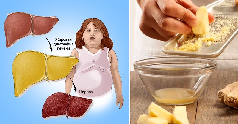 жирная печень