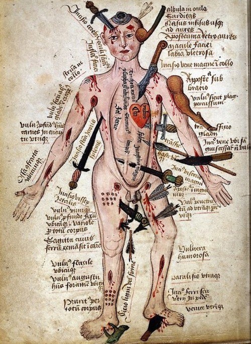 2. Военно-полевая хирургия. медицина, средние века