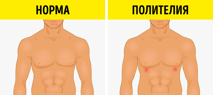 10 биологических аномалий человека, которые демонстрируют, насколько непредсказуема генетика