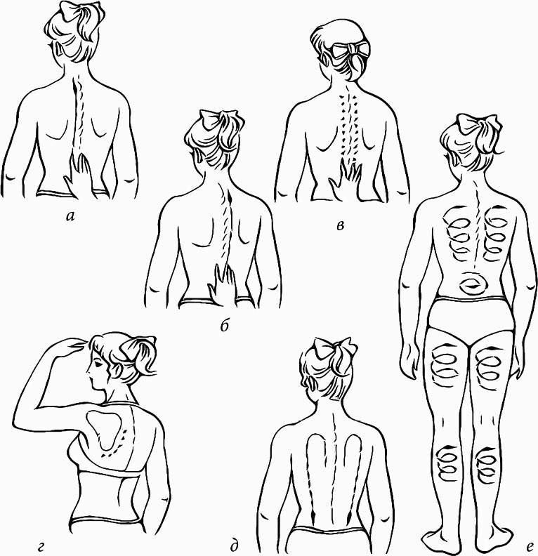 Схема массажа спины в картинках