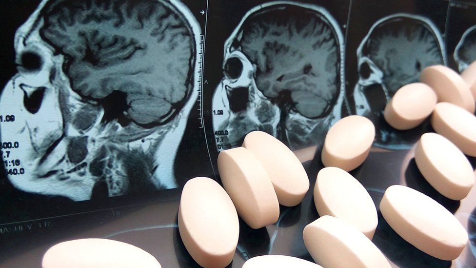 Зловещий парацетамол и другие таблетки: как они меняют нашу личность