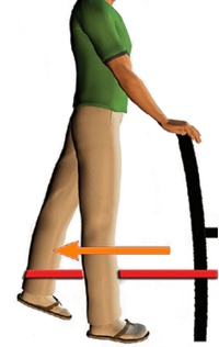 Реабилитация после эндопротезирования тазобедренного сустава здоровье