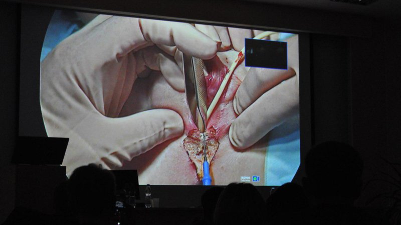 Хирург из Италии проводит уникальные операции в Сыктывкаре